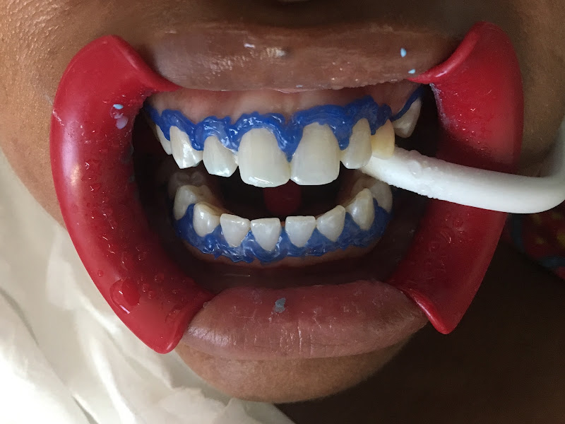Dental OLA Odontologic Latino América-Los Cabos - Dentist in Ampliación Juárez