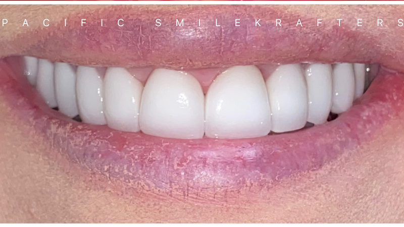 Pacific Smilekrafters