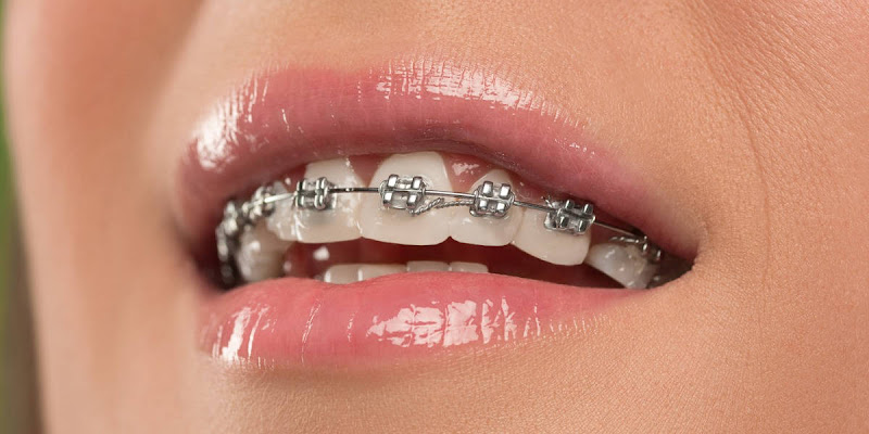 Smile Dental Center Miami