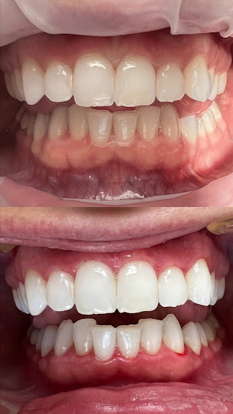 Mountain Ridge Dental