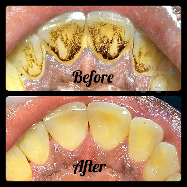La Smiles Solutions Ltd. - Dental clinic in Montego Bay