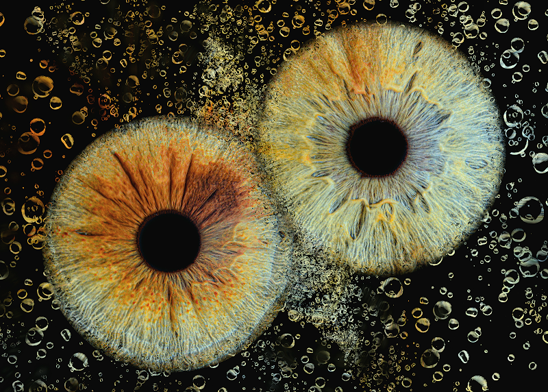Uniqueye Iris Photography
