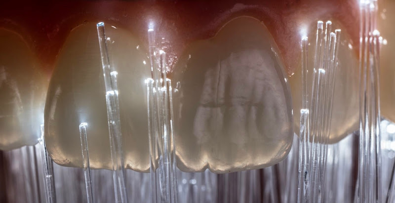 Dental Excellence - Dentist in Lomas del Faro