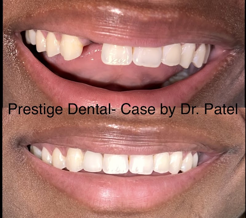 Prestige Dental Dallas & Implant Center photo