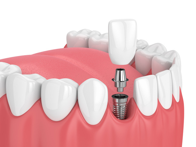 Nevada Dentistry & Braces - Dentist in Las Vegas