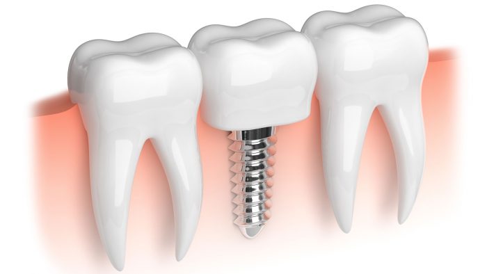 Island Dental