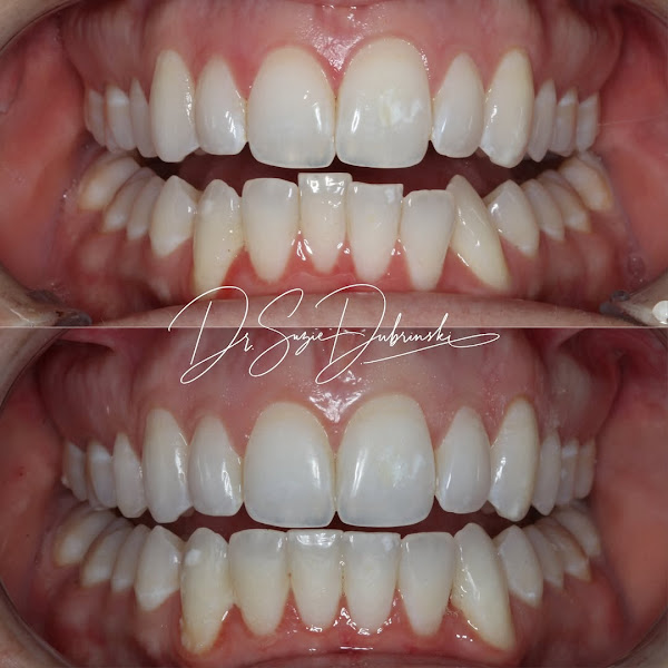 Sculpt Dental Spa