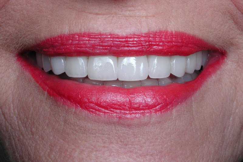 Adobe Dental Design of Sedona