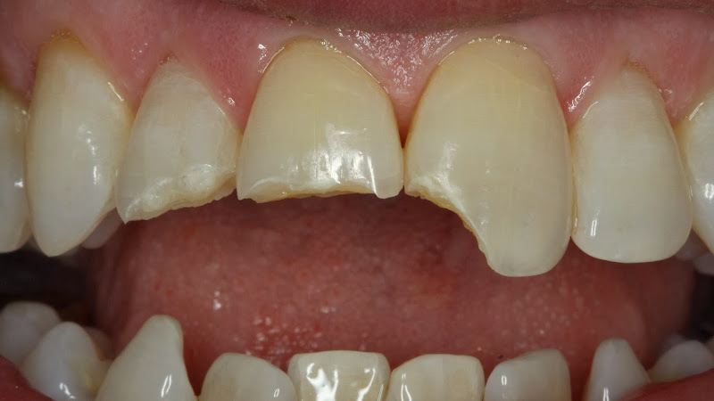 Longboat Key Dental - Dr. Michael J. O'Neil DDS - Dentist in Longboat Key