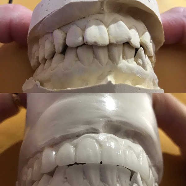 Central Valley Dentistry & Implants